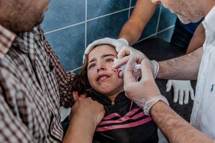 A Syrian refugee being treated for Leishmaniasis in Kilis, Turkey 