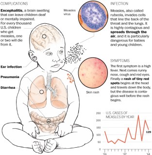 http://www.washingtonpost.com/national/health-science/how-to-recognize-measles/2014/04/24/27396486-cc1c-11e3-93eb-6c0037dde2ad_graphic.html